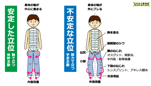 安定した立位と不安定な立位の解説イラスト